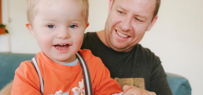 Father holding smiling special needs child 